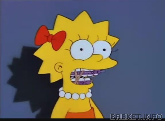 Lisa Simpson with braces