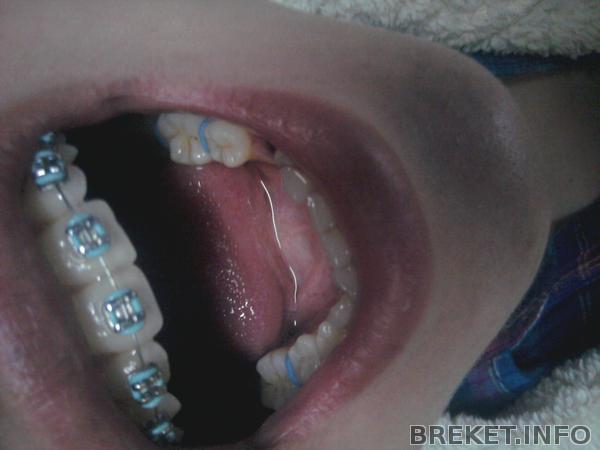 2013-10-03_20.09.25.jpg