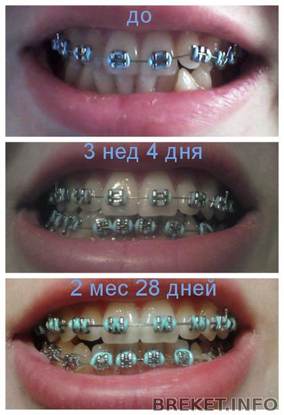 fotor010811940.jpg