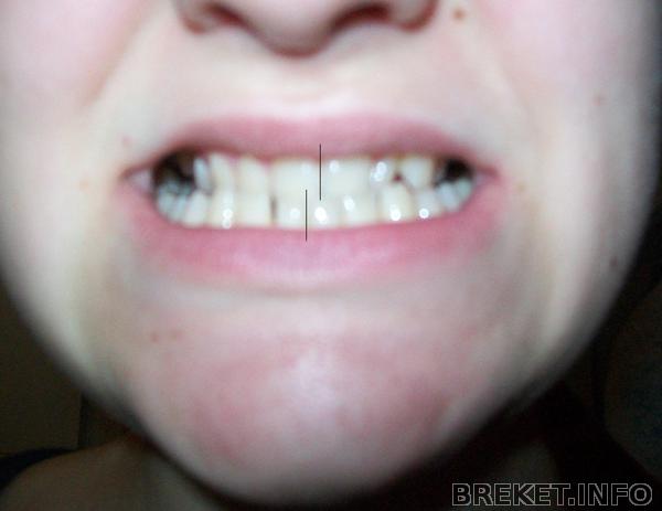 100_6541.jpg