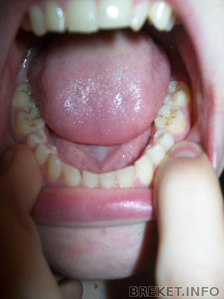 100_6630.jpg 100_6630.jpg
