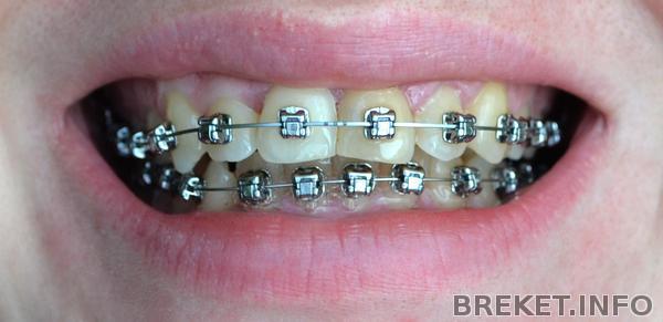 dsc_0749.jpg dsc_0749.jpg