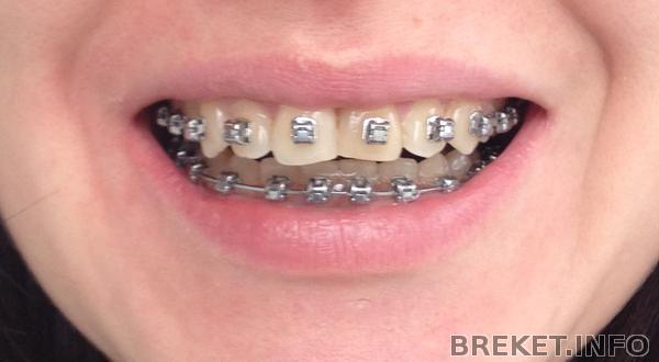 2014-10-06_12-56-16.jpg 10 мес. 12 дн. вч