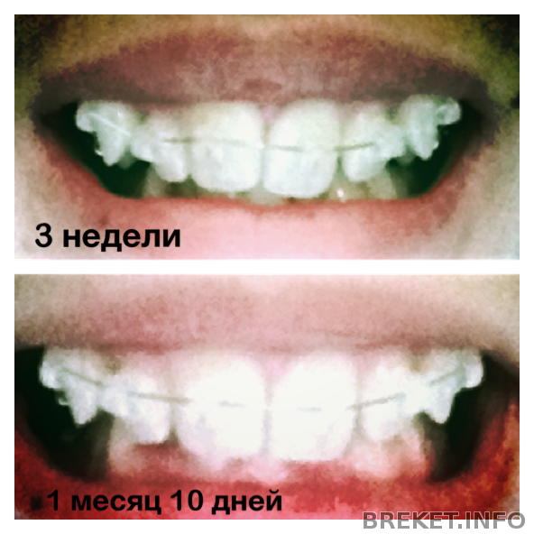 1 месяц 10 дней
