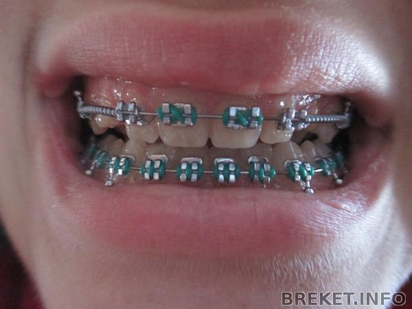 6 месяцев 23 дня