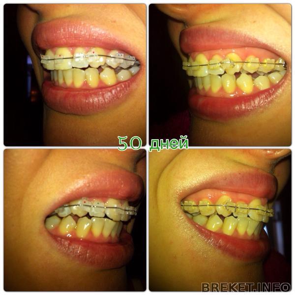 50 дней 50 дней