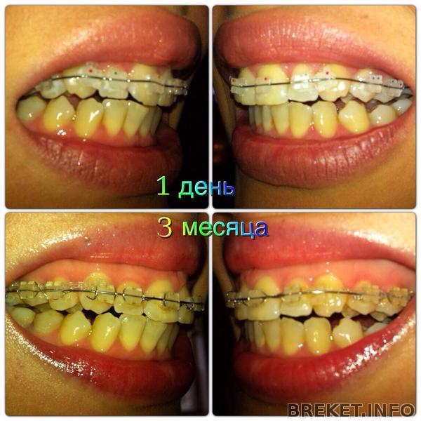 3 месяца, сбоку