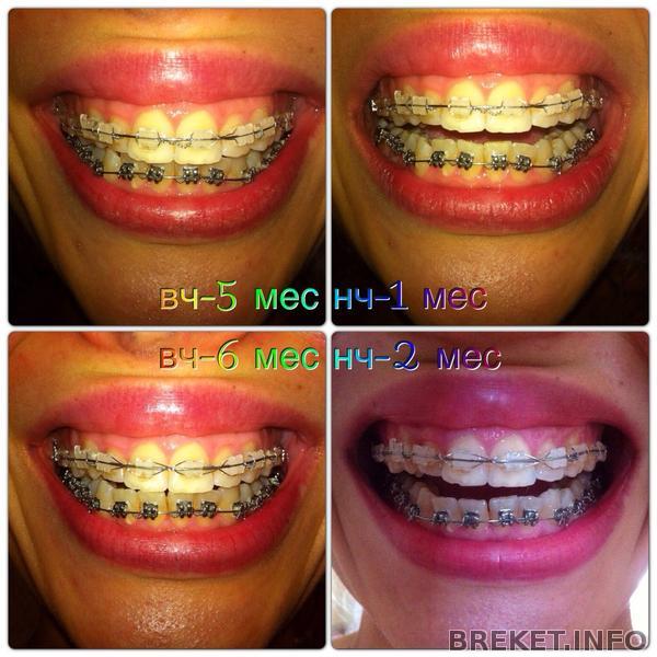 5-6 месяцев 5-6 месяцев