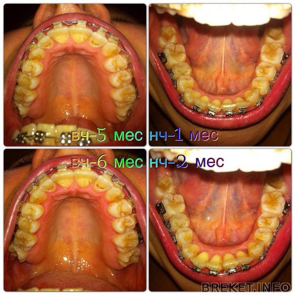 5-6 месяцев внутри 5-6 месяцев внутри