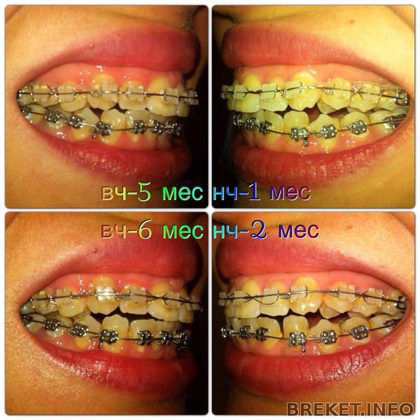 5-6 месяцев профиль 5-6 месяцев профиль