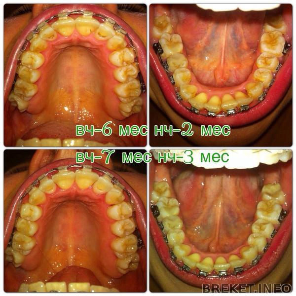 ja4xbnibr-0.jpg ja4xbnibr-0.jpg