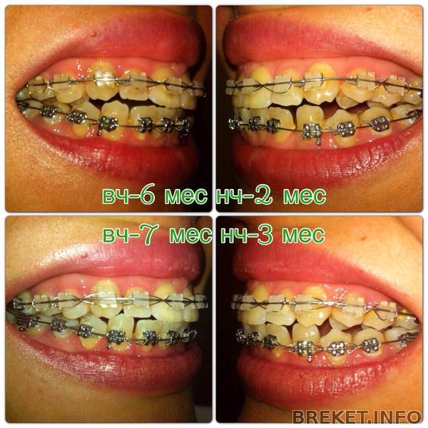 профиль вч-7 мес, нч-3 мес профиль вч-7 мес, нч-3 мес