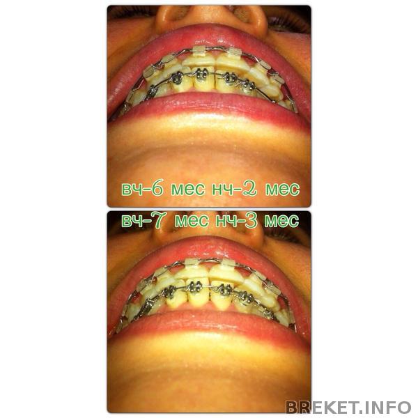 щель 7 мес щель 7 мес