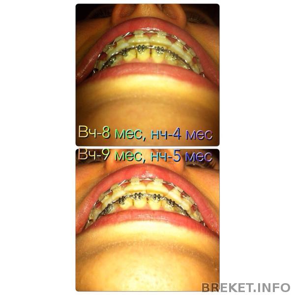 щель 8-9 мес