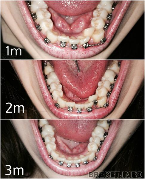 collagef.jpg collagef.jpg