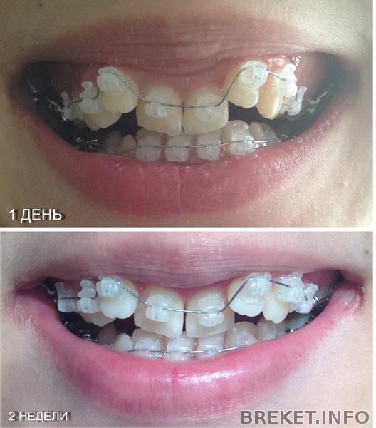 shchel.jpg shchel.jpg