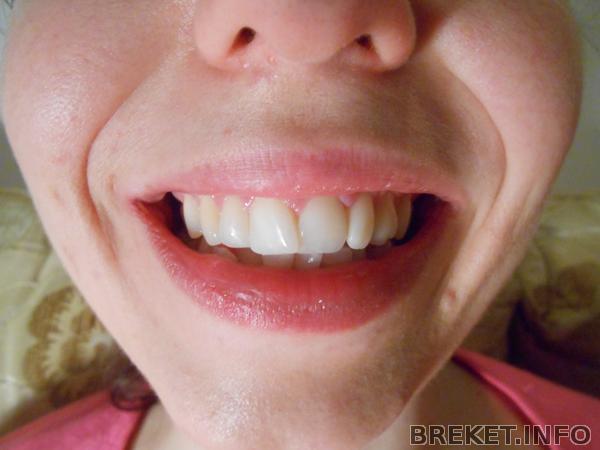 Улыбка.jpg Улыбка.jpg