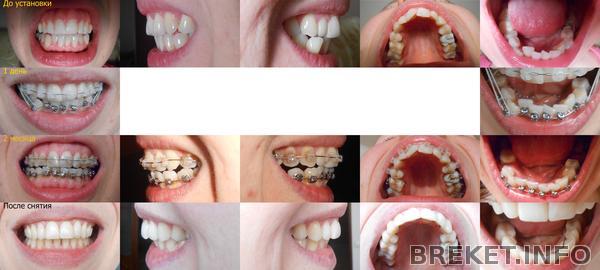 01_-_kollazh_-_do_i_posle.jpg 01_-_kollazh_-_do_i_posle.jpg