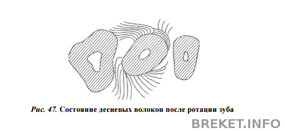 СПЕЦИАЛЬНЫЕ ВОПРОСЫ ОРТОДОНТИИ