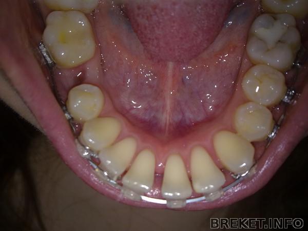 210420141549.jpg 210420141549.jpg