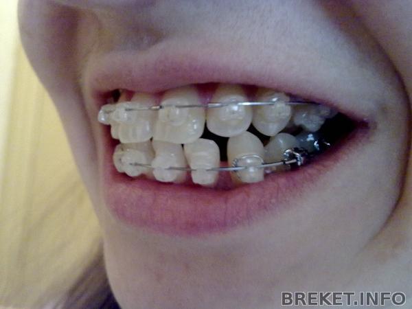 210420141554.jpg 210420141554.jpg