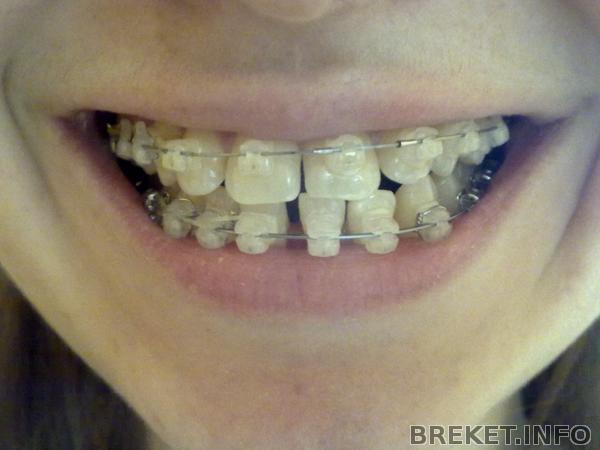 210420141555.jpg 210420141555.jpg