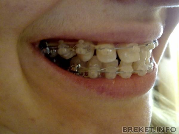 210420141556.jpg 210420141556.jpg