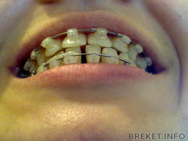 210420141558.jpg 210420141558.jpg