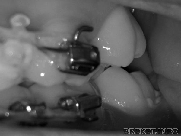 010120111640.jpg 010120111640.jpg