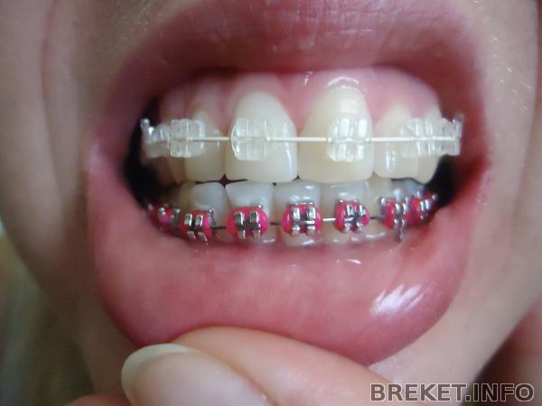 dsc08647.jpg dsc08647.jpg