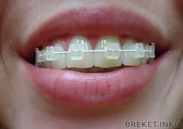 dsc08620.jpg dsc08620.jpg