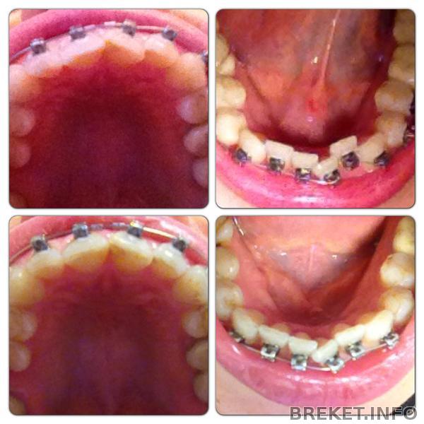 Два месяца спустя