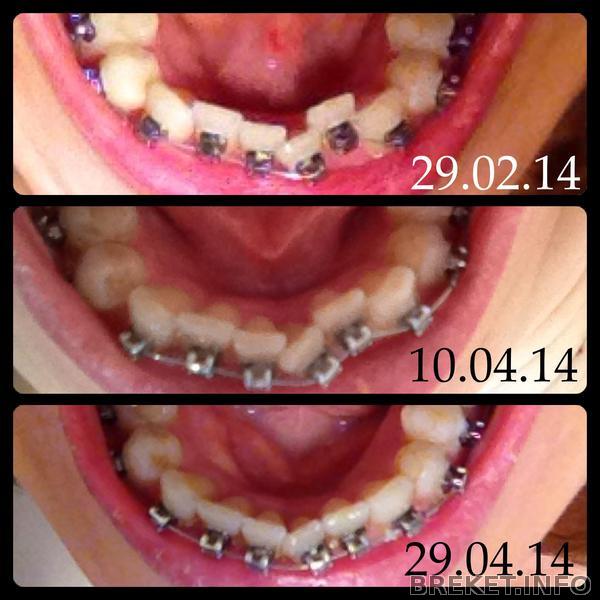 Для истории...