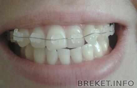 после установки