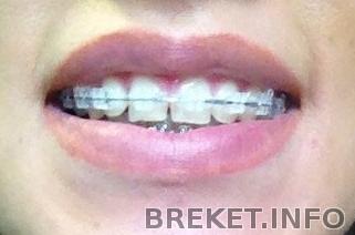 qepfbdes0ao.jpg qepfbdes0ao.jpg