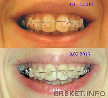 25_mesyaca.jpg 25_mesyaca.jpg