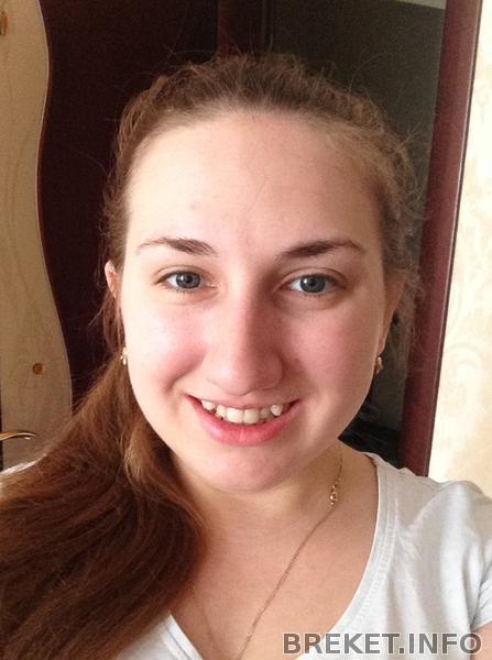 Перед выходом... последнее фото моих зубиков...