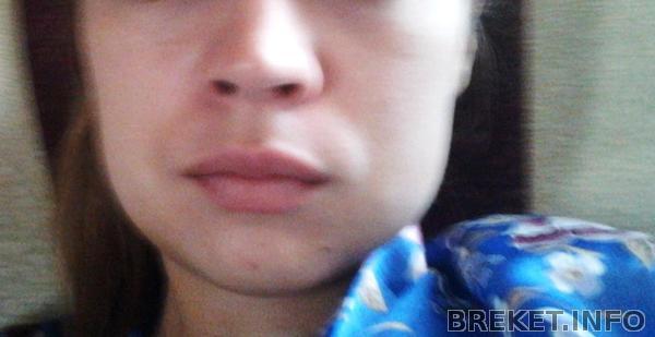 opuhol.jpg opuhol.jpg