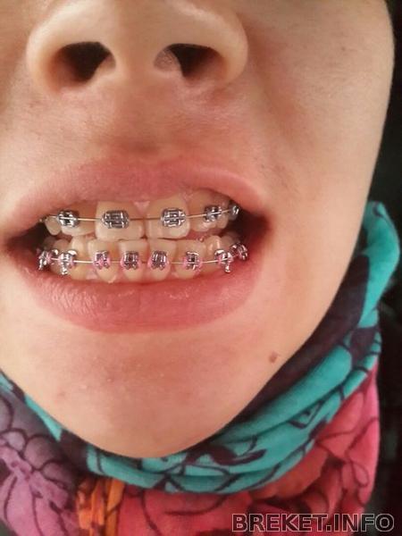 Вч 8 мес. НЧ почти 5 мес.jpg