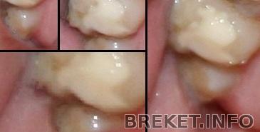 Злобная 8-ка