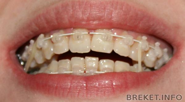 prikus.jpg prikus.jpg