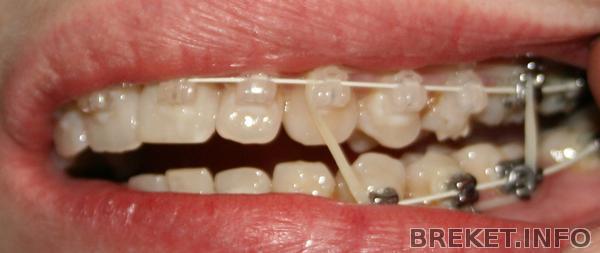 levo_2.jpg levo_2.jpg