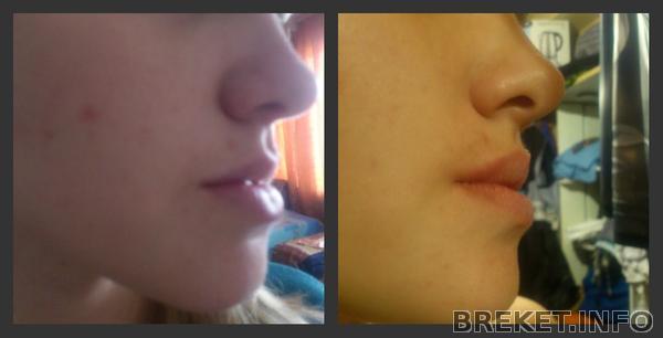 profil.jpg профиль в 1 день