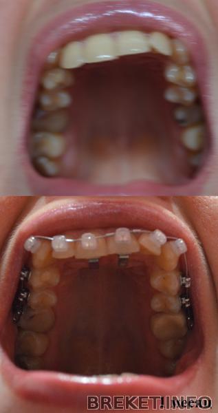 ВЧ 1 месяц.jpg