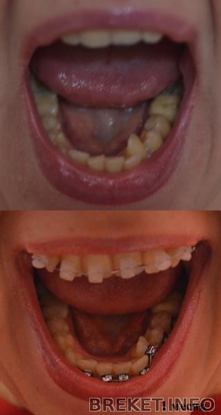 НЧ 1 месяц.jpg НЧ 1 месяц.jpg