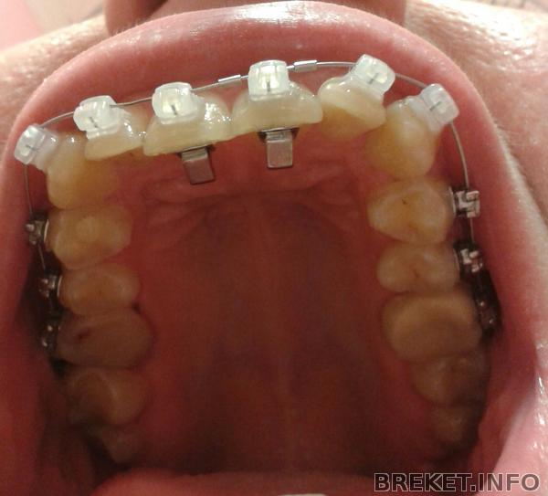 20140904_222634-1.jpg 20140904_222634-1.jpg