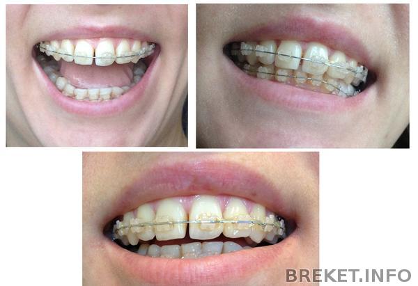 za_6-7_mes.shcheli.jpg za_6-7_mes.shcheli.jpg