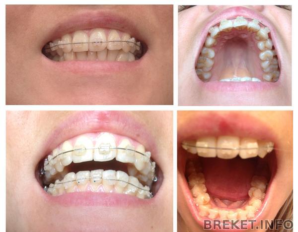 2_ustanovka.jpg 2_ustanovka.jpg