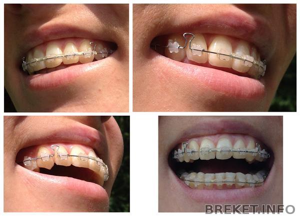 za_4_mes.do_snyatiya.jpg za_4_mes.do_snyatiya.jpg