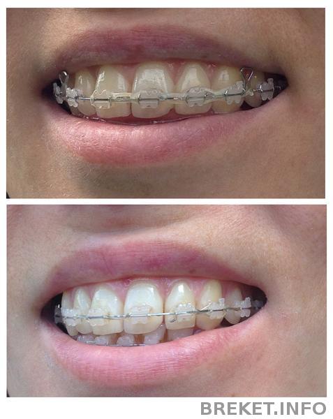 separaciya_do_i_posle.jpg separaciya_do_i_posle.jpg